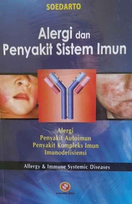 Cover Alergi dan Penyakit Sistem Imun :  Alergi, Penyakit Autoimun, Penyakit Kompleks Imun, Imunodefisiensi / Soedarto