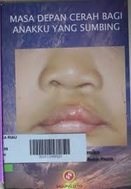 Cover Masa Depan Cerah Bagi Anakku yang Sumbing / Sudjatmiko, Gentur