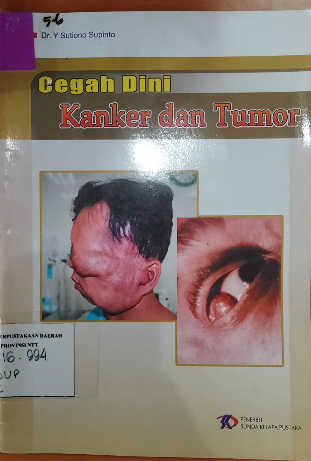 Cover Cegah Dini Kanker dan Tumor :   / Supinto,Y Sutiono
