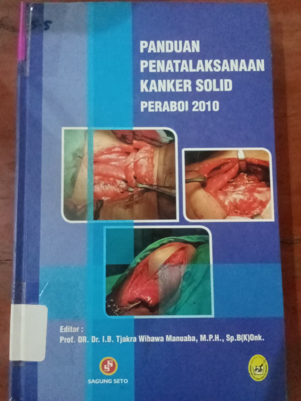Cover Panduan Penatalaksanaan Kanker Solid : Peraboi 2010 / Manuaba, Tjakarta Wihawa
