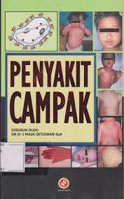 Cover Penyakit Campak / Setiawan, I Made