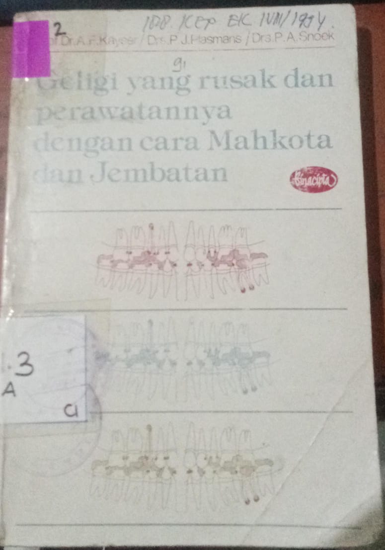 Cover Geligi Yang Rusak Dan Perawatannya Dengan Cara Mahkota Dan Jembatan / Plasmans